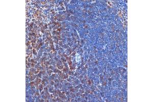 Immunohistochemistry of paraffin-embedded mouse spleen using PI3 Kinase p110 delta Rabbit mAb (ABIN7269326) at dilution of 1:100 (40x lens). (PIK3CD anticorps)