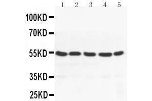 Anti-PPAR gamma antibody, Western blotting Lane 1: MM453 Cell Lysate Lane 2: MM231 Cell Lysate Lane 3: HELA Cell Lysate Lane 4: JURKAT Cell Lysate Lane 5:  Cell Lysate (PPARG anticorps  (N-Term))