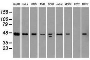 Image no. 14 for anti-Sjogren Syndrome Antigen B (SSB) antibody (ABIN1501146)