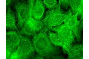 Immunocytochemistry/Immunofluorescence analysis using Mouse Anti-TrpV3 Monoclonal Antibody, Clone S15-39 (ABIN2485241).