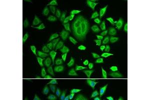 Immunofluorescence analysis of MCF-7 cells using RBP3 Polyclonal Antibody (RBP3 anticorps)