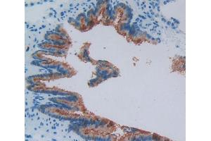 Used in DAB staining on fromalin fixed paraffin- embedded bronchus tissue (VPREB1 anticorps  (AA 43-128))