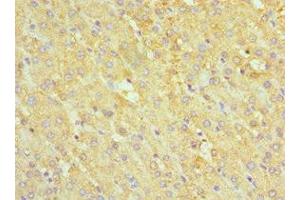Immunohistochemistry of paraffin-embedded human liver tissue using ABIN7142463 at dilution of 1:100