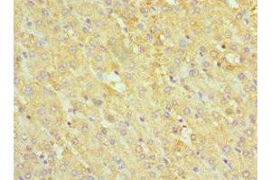 Immunohistochemistry of paraffin-embedded human liver tissue using ABIN7142463 at dilution of 1:100 (ABAT anticorps  (AA 29-300))