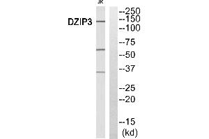 Immunohistochemistry analysis of paraffin-embedded human breast carcinoma tissue, using DZIP3 antibody. (DZIP3 anticorps)