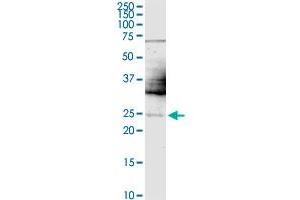 TWIST1 monoclonal antibody (M01), clone 3E11.