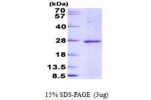 SDS-PAGE (SDS) image for Jun Dimerization Protein 2 (JDP2) (AA 1-163) protein (His tag) (ABIN6387177)