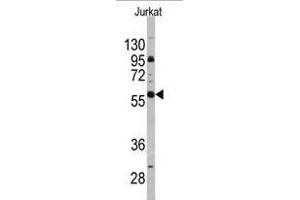 Image no. 1 for anti-CD19 Molecule (CD19) (C-Term) antibody (ABIN357030) (CD19 anticorps  (C-Term))