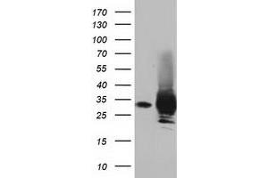 Western Blotting (WB) image for anti-Pyrroline-5-Carboxylate Reductase Family, Member 2 (PYCR2) antibody (ABIN1499982)