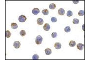 AP20058PU-N CD107b/LAMP2 antibody staining of HepG2 cells by Immunocytochemistry at 10 μg/ml.