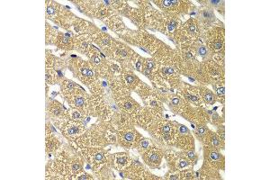 Immunohistochemistry of paraffin-embedded human liver injury using TMED10 antibody at dilution of 1:100 (x40 lens). (TMED10 anticorps)