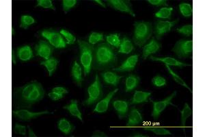 Immunofluorescence of monoclonal antibody to MAPK12 on HeLa cell. (MAPK12 anticorps  (AA 251-367))