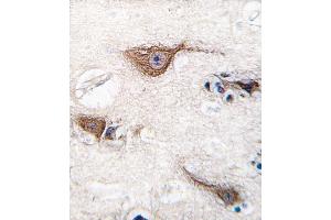 Formalin-fixed and paraffin-embedded human brain tissue reacted with UCHL1 (Park5) antibody (N-term) (ABIN388868 and ABIN2839164) , which was peroxidase-conjugated to the secondary antibody, followed by DAB staining.