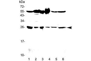 Western blot testing of 1) rat testis, 2) rat brain, 3) mouse testis, 4) mouse brain, 5) human HeLa and 6) human MCF7 lysate with GSTM3 antibody at 0. (GSTM3 anticorps)