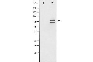 Western blot analysis of Lamin A/C phosphorylation expression in HeLa whole cell lysates,The lane on the left is treated with the antigen-specific peptide. (Lamin A/C anticorps  (pSer392))