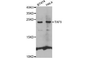 Western blot analysis of extracts of various cell lines, using TAF9 antibody.