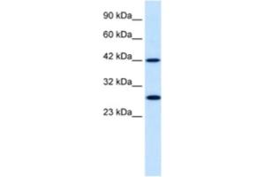 Western Blotting (WB) image for anti-Proteasome (Prosome, Macropain) 26S Subunit, Non-ATPase, 4 (Psmd4) antibody (ABIN2460431) (PSMD4/ASF anticorps)