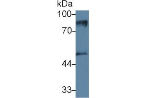 Detection of PKCe in Mouse Cerebrum lysate using Monoclonal Antibody to Protein Kinase C Epsilon (PKCe) (PKC epsilon anticorps  (AA 403-672))