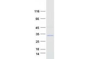 Validation with Western Blot