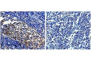 The image on the left is immunohistochemistry of paraffin-embedded Human tonsil tissue using 31002 (PCNA Antibody) at dilution 1/25, on the right is treated with the fusion protein.