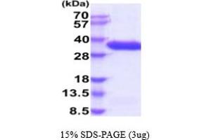 SDS-PAGE (SDS) image for Complement Factor B (CFB) (AA 26-259) protein (His tag) (ABIN5854833)