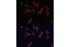 Immunofluorescence analysis of C6 cells using IQG Polyclonal Antibody (ABIN7268020) at dilution of 1:100 (40x lens). (IQGAP1 anticorps  (AA 500-750))