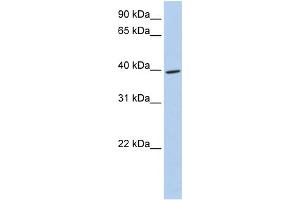 WB Suggested Anti-MEIS3 Antibody Titration:  0. (MEIS3 anticorps  (Middle Region))