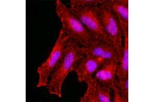 Immunofluorescence of human HeLa cells stained with KCTD15 monoclonal antibody, clone AT4C3  (1 : 500) with Texas Red (Red). (KCTD15 anticorps  (AA 1-234))