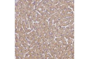 Immunohistochemical staining of human liver with UTP23 polyclonal antibody  shows moderate cytoplasmic positivity in hepatocytes at 1:50-1:200 dilution. (UTP23 anticorps)