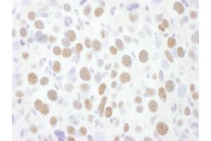 Immunohistochemistry (IHC) image for anti-Cyclin-Dependent Kinase 9 (CDK9) (AA 322-372) antibody (ABIN7453621) (CDK9 anticorps  (AA 322-372))