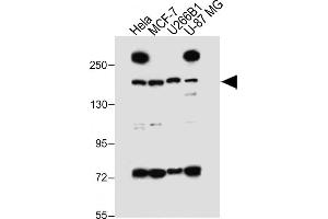 All lanes : Anti-UTY_HUN at 1:1000 dilution Lane 1: Hela whole cell lysate Lane 2: MCF-7 whole cell lysate Lane 3: U266B1 whole cell lysate Lane 4: U-87 MG whole cell lysate Lysates/proteins at 20 μg per lane.