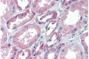 Human Kidney (formalin-fixed, paraffin-embedded) stained with TRIM68 antibody ABIN462217 followed by biotinylated goat anti-rabbit IgG secondary antibody ABIN481713, alkaline phosphatase-streptavidin and chromogen.