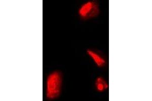 Immunofluorescent analysis of RPS5 staining in Hela cells. (RPS5 anticorps)