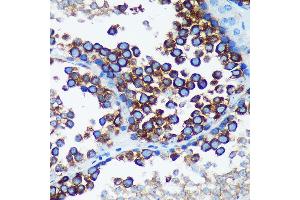 Immunohistochemistry of paraffin-embedded Mouse testis using R Rabbit pAb (ABIN7269785) at dilution of 1:100 (40x lens).