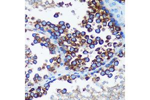 Immunohistochemistry of paraffin-embedded Mouse testis using R Rabbit pAb (ABIN7269785) at dilution of 1:100 (40x lens). (RABGAP1 anticorps  (AA 830-1069))