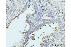 IHC analysis of RPL23 using anti-RPL23 antibody (ABIN7599808).