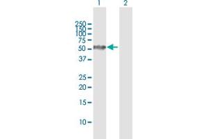 Western Blot analysis of CAP1 expression in transfected 293T cell line by CAP1 MaxPab polyclonal antibody.