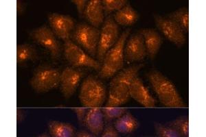 Immunofluorescence analysis of HeLa cells using B3GNT4 Polyclonal Antibody at dilution of 1:100. (B3GNT4 anticorps)