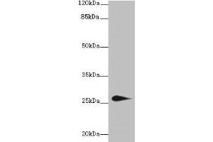 Western blot All lanes: TMEM174 antibody at 0. (TMEM174 anticorps  (AA 94-243))