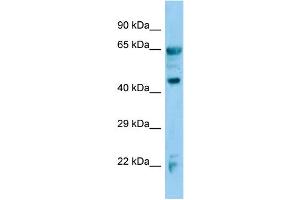 Host:  Rabbit  Target Name:  Adh7  Sample Type:  Mouse Lung lysates  Antibody Dilution:  1. (ADH7 anticorps  (C-Term))