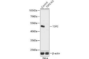 Western blot analysis of extracts from normal (control) and TDP2 knockout (KO) HeLa cells using TDP2 Polyclonal Antibody at dilution of 1:3000. (TDP2 anticorps)