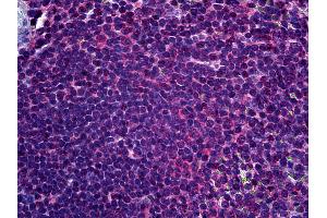 Anti-FADS1 antibody IHC of human spleen. (FADS1 anticorps  (AA 1-100))