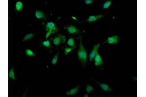 anti-Ubiquitin Specific Peptidase 4 (USP4) (AA 632-810) antibody