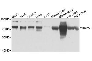 Western blot analysis of extracts of various cell lines, using HSPA2 antibody. (HSPA2 anticorps  (AA 400-639))