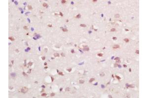 Formalin-fixed and paraffin embedded at brain labeled with Anti-RFX4 Polyclonal Antibody, Unconjugated (ABIN1386336) at 1:200 followed by conjugation to the secondary antibody and DAB staining (RFX4 anticorps  (AA 101-200))