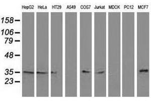 Image no. 3 for anti-Chromosome 20 Open Reading Frame 43 (C20orf43) antibody (ABIN1497039)