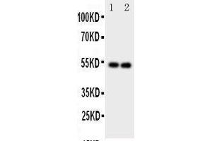 Anti-GABA A Receptor alpha 1 antibody, Western blotting Lane 1: Rat Brain Tissue Lysate Lane 2: Rat Brain Tissue Lysate (GABRA1 anticorps  (C-Term))