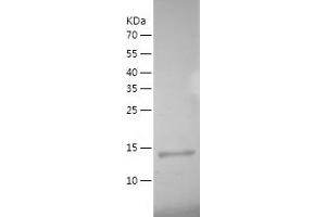 Western Blotting (WB) image for Bromodomain and PHD Finger Containing, 1 (BRPF1) (AA 628-746) protein (His-IF2DI Tag) (ABIN7122042)