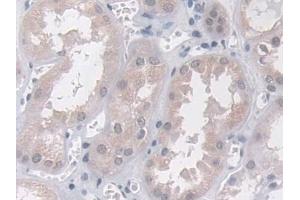 Detection of VAPB in Human Kidney Tissue using Polyclonal Antibody to Vesicle Associated Membrane Protein Associated Protein B (VAPB)