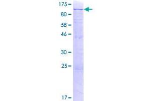 Image no. 1 for Melanoma Antigen Family D, 1 (MAGED1) (AA 1-778) protein (GST tag) (ABIN1310079)